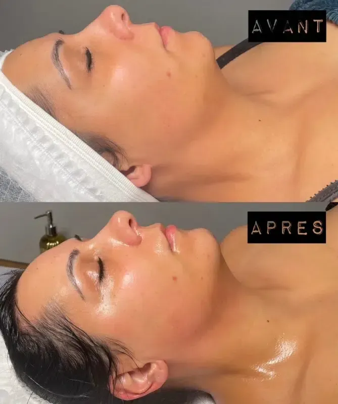 lymphomodelage-6